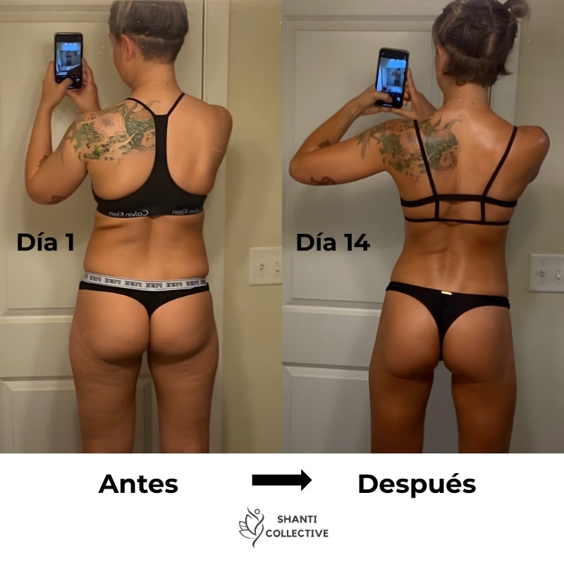 Mozzes – Dispositivo de Masaje para la Eliminación de la Celulitis