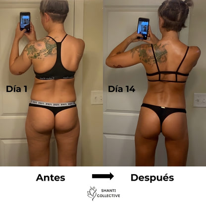 Mozzes – Dispositivo de Masaje para la Eliminación de la Celulitis